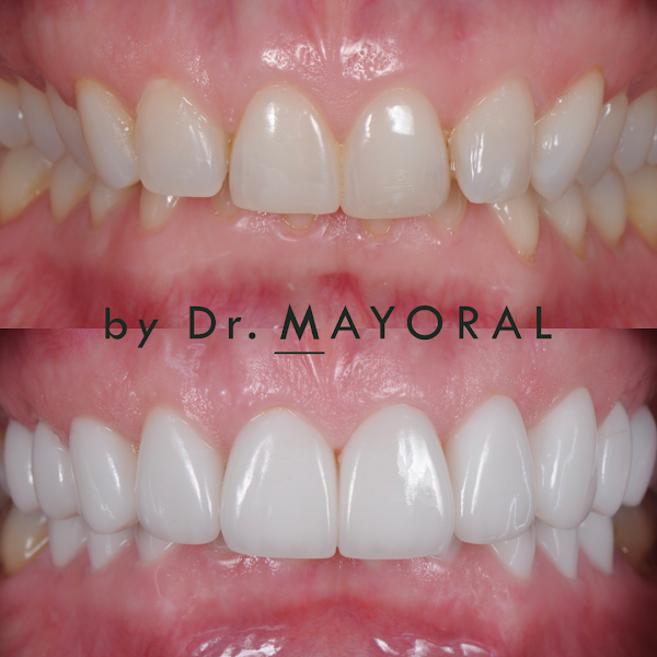 Barcelona Smile Center – Estética Dental