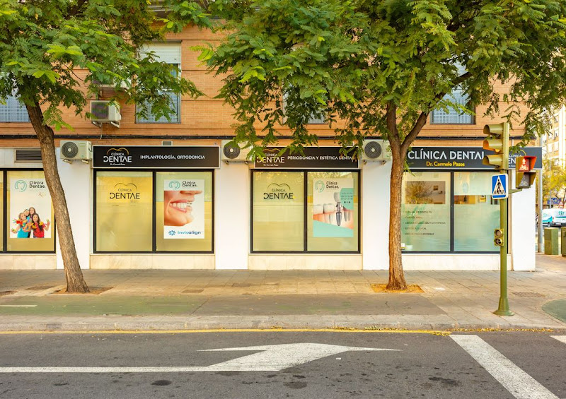 CLINICA DENTAE. Clinica dental Sevilla . Dr. Carmelo Pazos