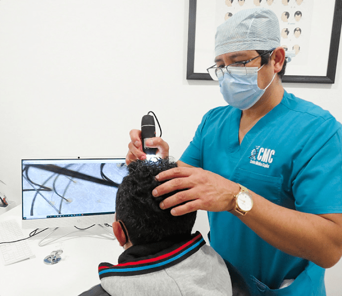 Capyderma | Injerto Capilar Dr. Roger Gallegos