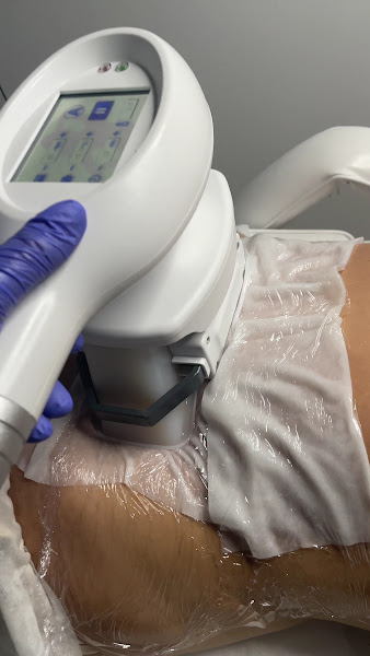 Clínica Altos de Croft: Micropigmentación capilar, facial y estética integral