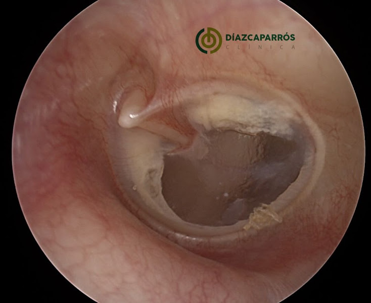 Clínica Díaz Caparrós Otorrinolaringología y Medicina Estética