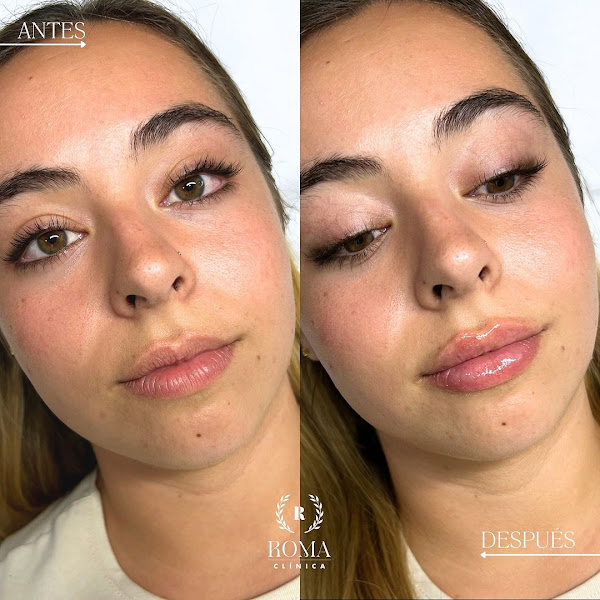 Clínica Roma – Medicina Estética Málaga