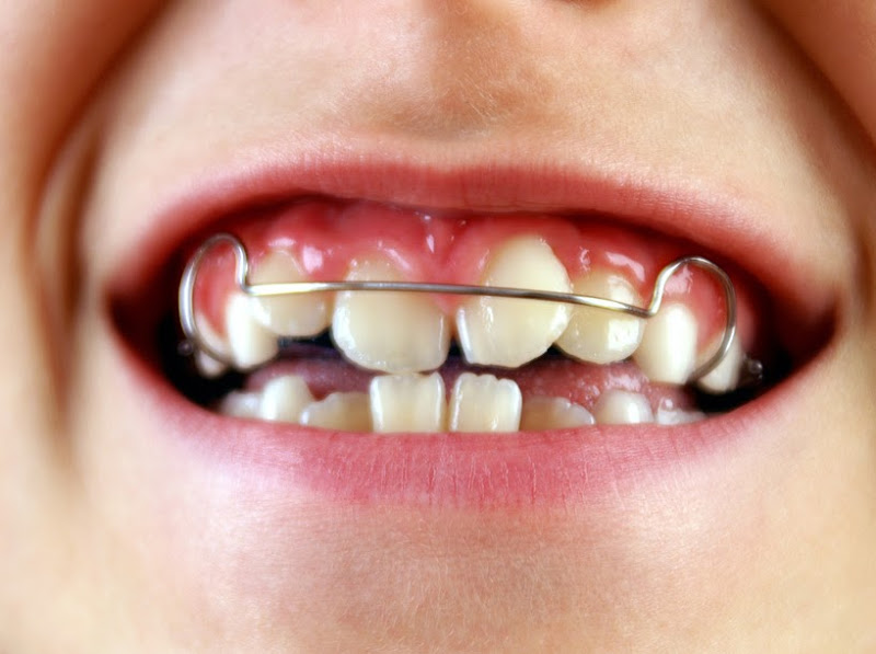 Instituto Maxilofacial Dr. Mateo Arias- Clínica Cirugía Maxilofacial, Dermatología, Medicina Estética, Periodoncia Badajoz