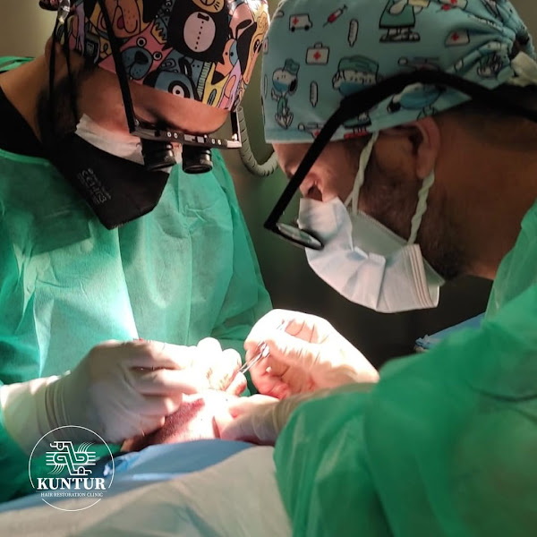 Kuntur Clinic | Injerto y Mesoterapia Capilar en Barcelona