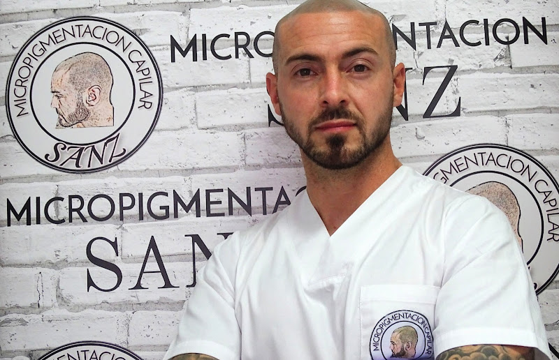 Micropigmentación Capilar Sanz