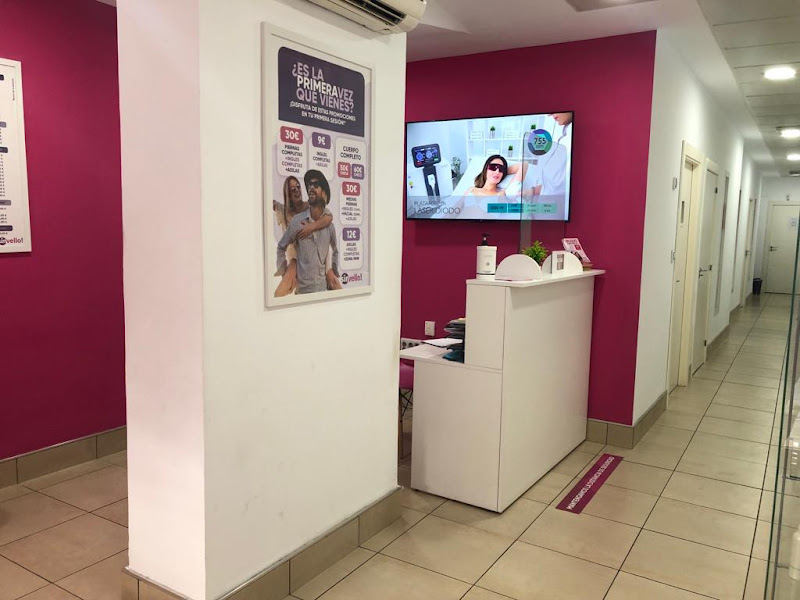 SinVello! Jaén | Depilación Láser Diodo